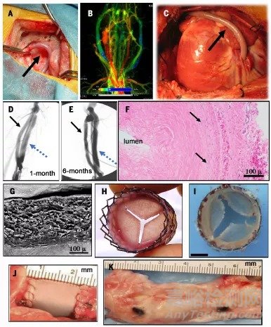 Science綜述：人造血管