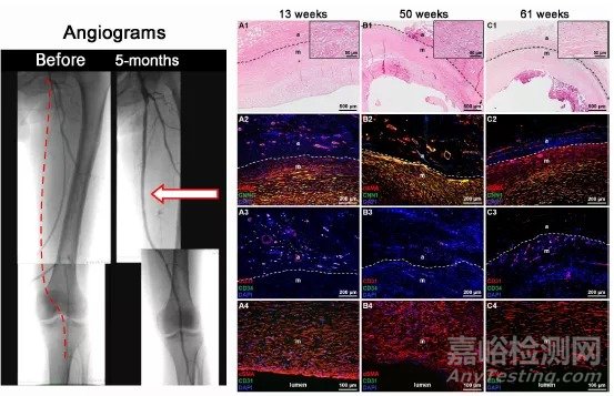 Science綜述：人造血管