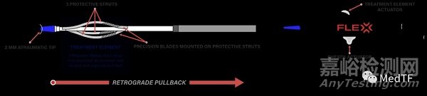 FLEX Vessel Prep：獲批用于治療血管支架內(nèi)再狹窄