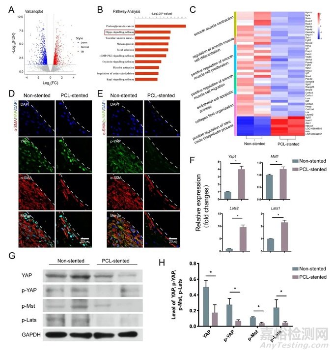 新型生物可降解血管外支架通過Hippo-YAP和mTOR信號通路調(diào)節(jié)靜脈移植物重塑