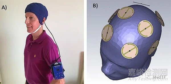 可以減輕老年癡呆病狀的新產(chǎn)品:MemorEM治療帽
