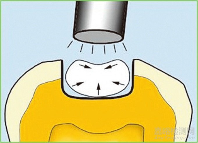 牙科粘合劑的歷史