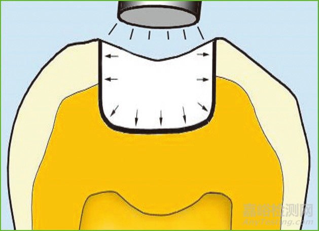 牙科粘合劑的歷史