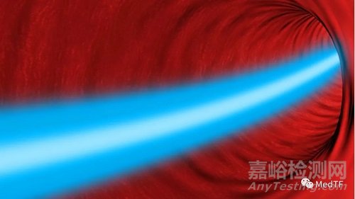 Alucent NVS:“天然支架”有望避免動(dòng)靜脈瘺再狹窄