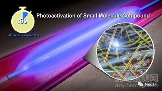 Alucent NVS:“天然支架”有望避免動(dòng)靜脈瘺再狹窄