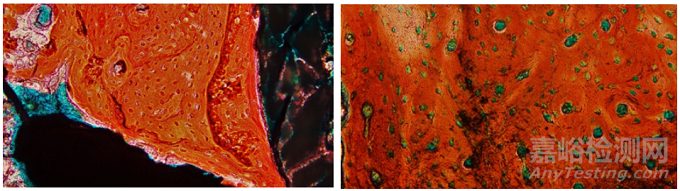 含植入物不脫鈣骨組織病理切片技術在骨組織形態(tài)學研究中的應用