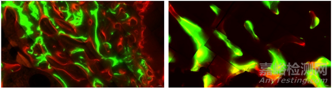 含植入物不脫鈣骨組織病理切片技術在骨組織形態(tài)學研究中的應用