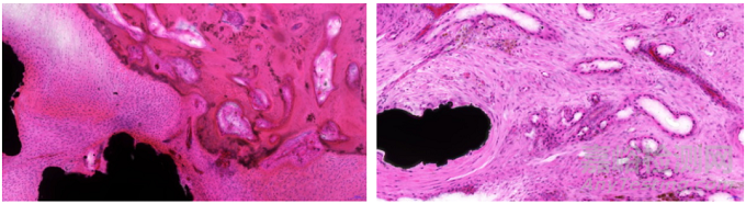含植入物不脫鈣骨組織病理切片技術在骨組織形態(tài)學研究中的應用