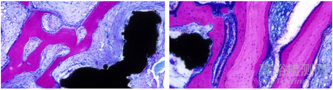 含植入物不脫鈣骨組織病理切片技術在骨組織形態(tài)學研究中的應用