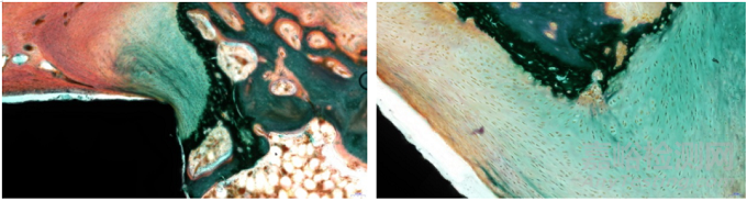 含植入物不脫鈣骨組織病理切片技術在骨組織形態(tài)學研究中的應用