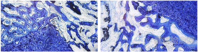含植入物不脫鈣骨組織病理切片技術在骨組織形態(tài)學研究中的應用