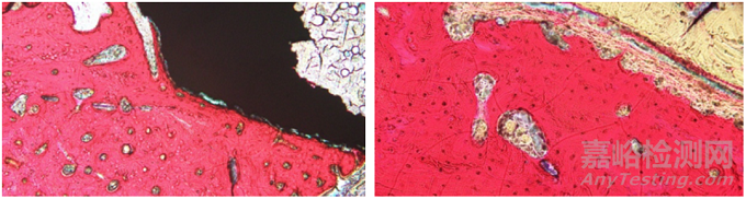 含植入物不脫鈣骨組織病理切片技術在骨組織形態(tài)學研究中的應用