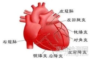 MagicTouch SCB：小冠狀動脈藥物球囊