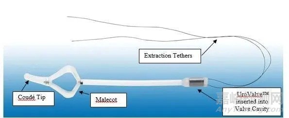 CymActive：允許尿失禁患者自主控制排尿，恢復(fù)正常人生活