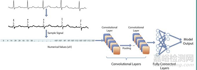 心血管疾病中的人工智能應(yīng)用