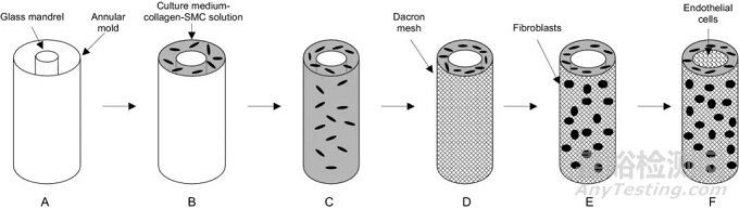 人工血管的發(fā)展歷史和技術(shù)要求