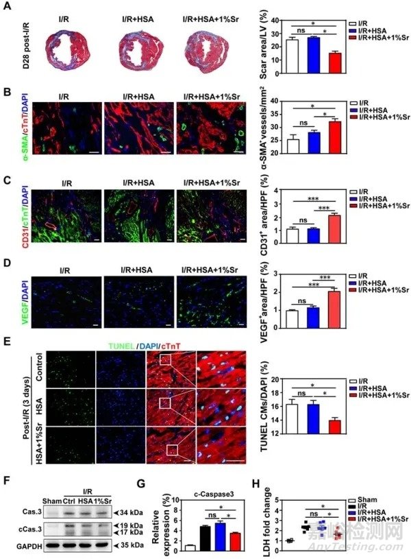 鍶離子治療心肌缺血/再灌注損傷研究獲進(jìn)展