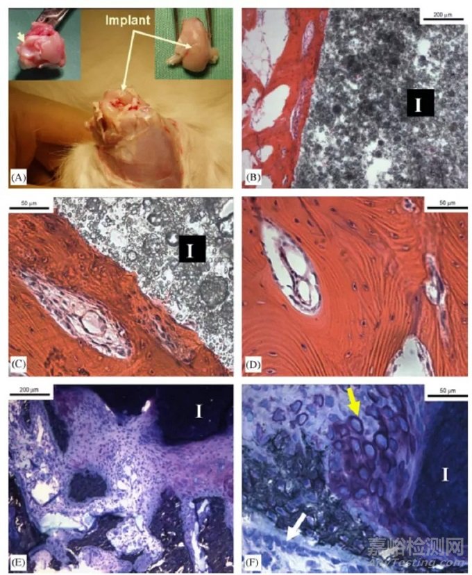 用于骨科植入物的檸檬酸基復(fù)合材料-Citregen的優(yōu)異性能及其產(chǎn)業(yè)化和技術(shù)優(yōu)勢(shì)