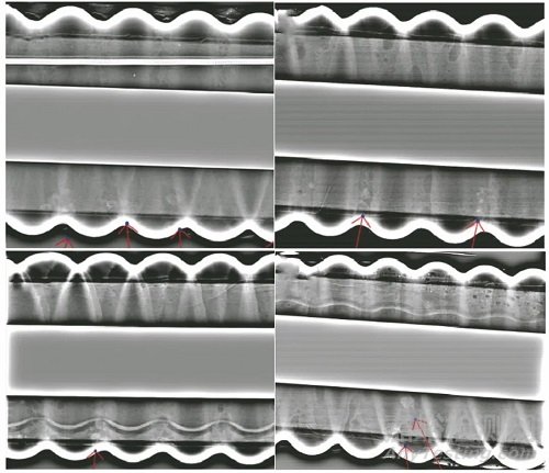 高壓電纜阻水緩沖層燒蝕缺陷的射線檢測