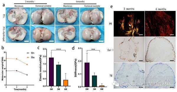 3D生物打印仿生半月板支架應(yīng)用于組織工程領(lǐng)域