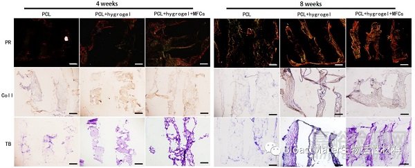3D生物打印仿生半月板支架應(yīng)用于組織工程領(lǐng)域