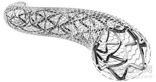 頸動(dòng)脈覆膜支架