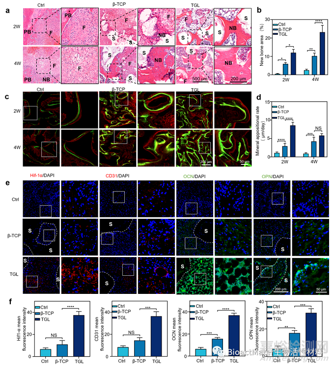 受“蓮蓬”啟發(fā)構(gòu)建內(nèi)部血管化的3D打印支架促進(jìn)骨修復(fù)