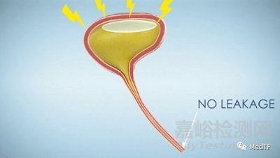 AeraVes:壓力性尿失禁全新療法