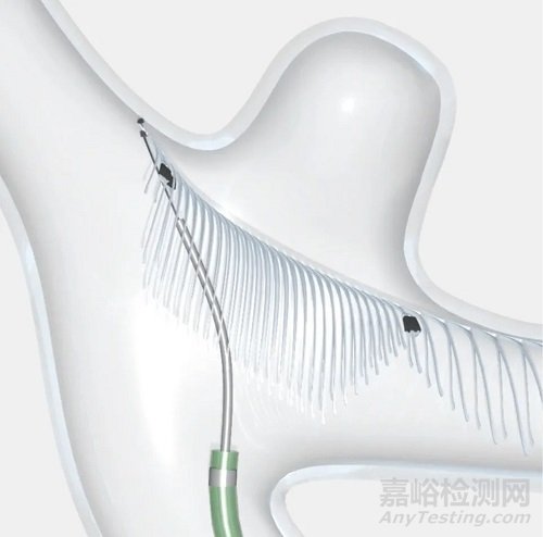 eCLIPs:類蜈蚣似的動(dòng)脈瘤治療器械