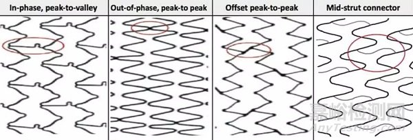 從選材到涂層，支架設(shè)計(jì)的5個(gè)步驟