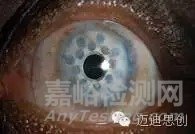 國產(chǎn)人工角膜6月用于臨床，超全的人工角膜研發(fā)科普貼