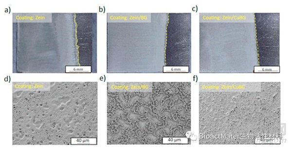 玉米蛋白-生物活性玻璃/銅基涂層用于植入式不銹鋼的抗菌、促血管生成和促骨整合：旨在促進(jìn)骨愈合