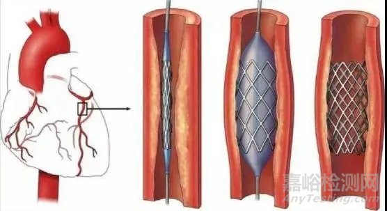 心臟支架工業(yè)化背后的高精密激光加工