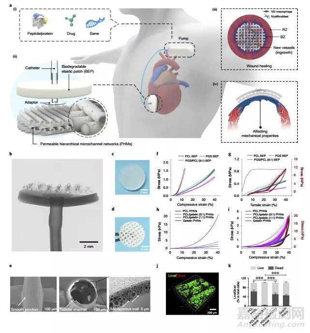 中國科學(xué)家研發(fā)出可改善心臟功能和組織修復(fù)的心臟外膜裝置