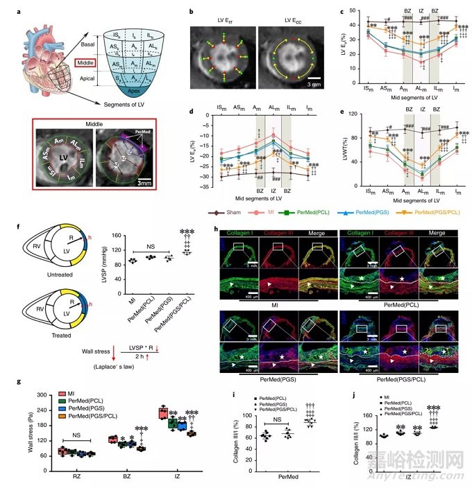 中國科學(xué)家研發(fā)出可改善心臟功能和組織修復(fù)的心臟外膜裝置
