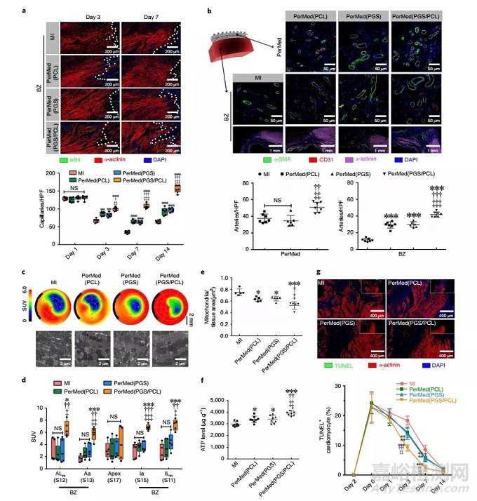 中國科學(xué)家研發(fā)出可改善心臟功能和組織修復(fù)的心臟外膜裝置