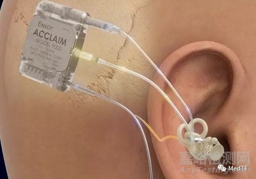 Acclaim:顛覆性的完全可植式人工耳蝸