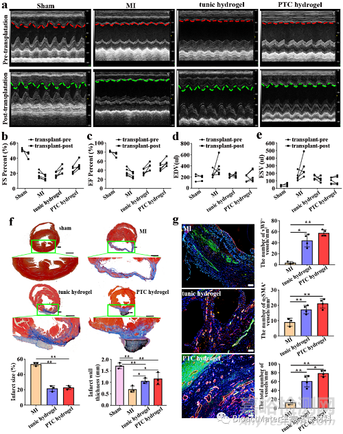 從海洋養(yǎng)殖廢棄物到促心梗修復(fù)的天然導(dǎo)電心肌補(bǔ)片