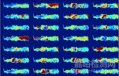 醫(yī)療器械領域人工智能技術的發(fā)展