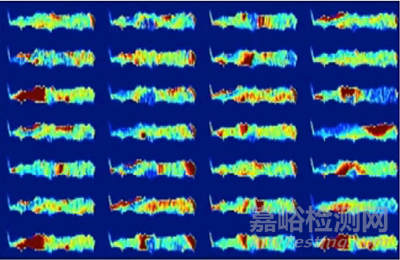 醫(yī)療器械領域人工智能技術的發(fā)展