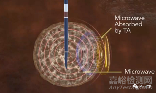 HeatSYNC Gel：讓微波消融變更為圓潤(rùn)