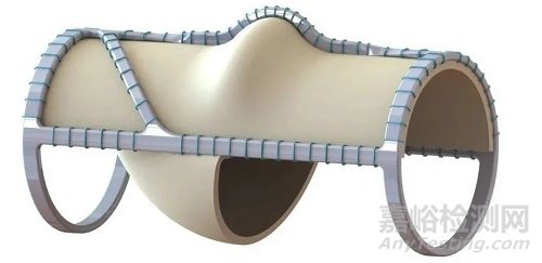 VenoValve：有望解決下肢慢性靜脈功能不全患者長(zhǎng)期困擾