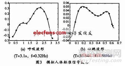基于MATLAB軟件心跳呼吸模型的仿真設(shè)計