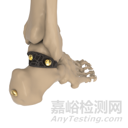 增材制造技術在骨科植入物領域的應用