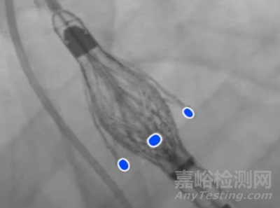 “Jenavalve” Trilogy TAVI 輸送系統(tǒng)獲CE審批，使自膨主瓣和輸送系統(tǒng)成為可能