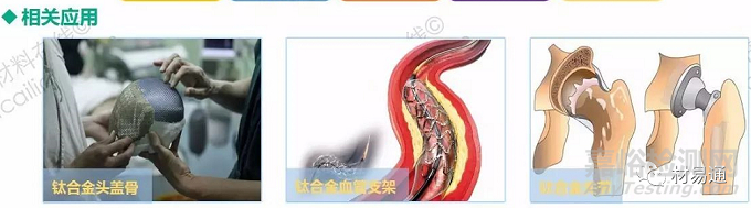 生物醫(yī)用金屬材料現(xiàn)狀與進(jìn)展