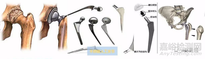 生物醫(yī)用金屬材料現(xiàn)狀與進(jìn)展