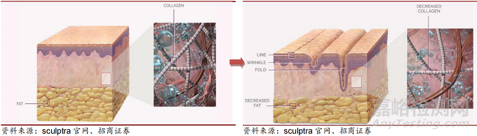 童顏針市場邁向合規(guī)，有望成為下一風口!