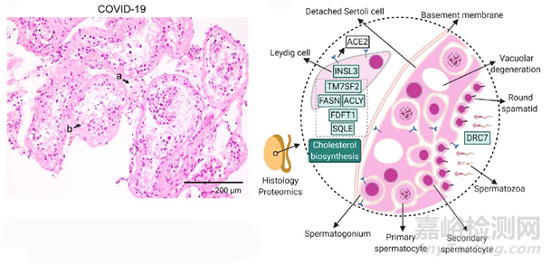 人工智能聯(lián)合蛋白質(zhì)組學(xué)引發(fā)藥物研發(fā)生物學(xué)底層變革