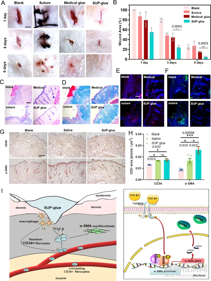 可加速傷口愈合、幾乎不結(jié)痂的超級(jí)生物膠水簡(jiǎn)介